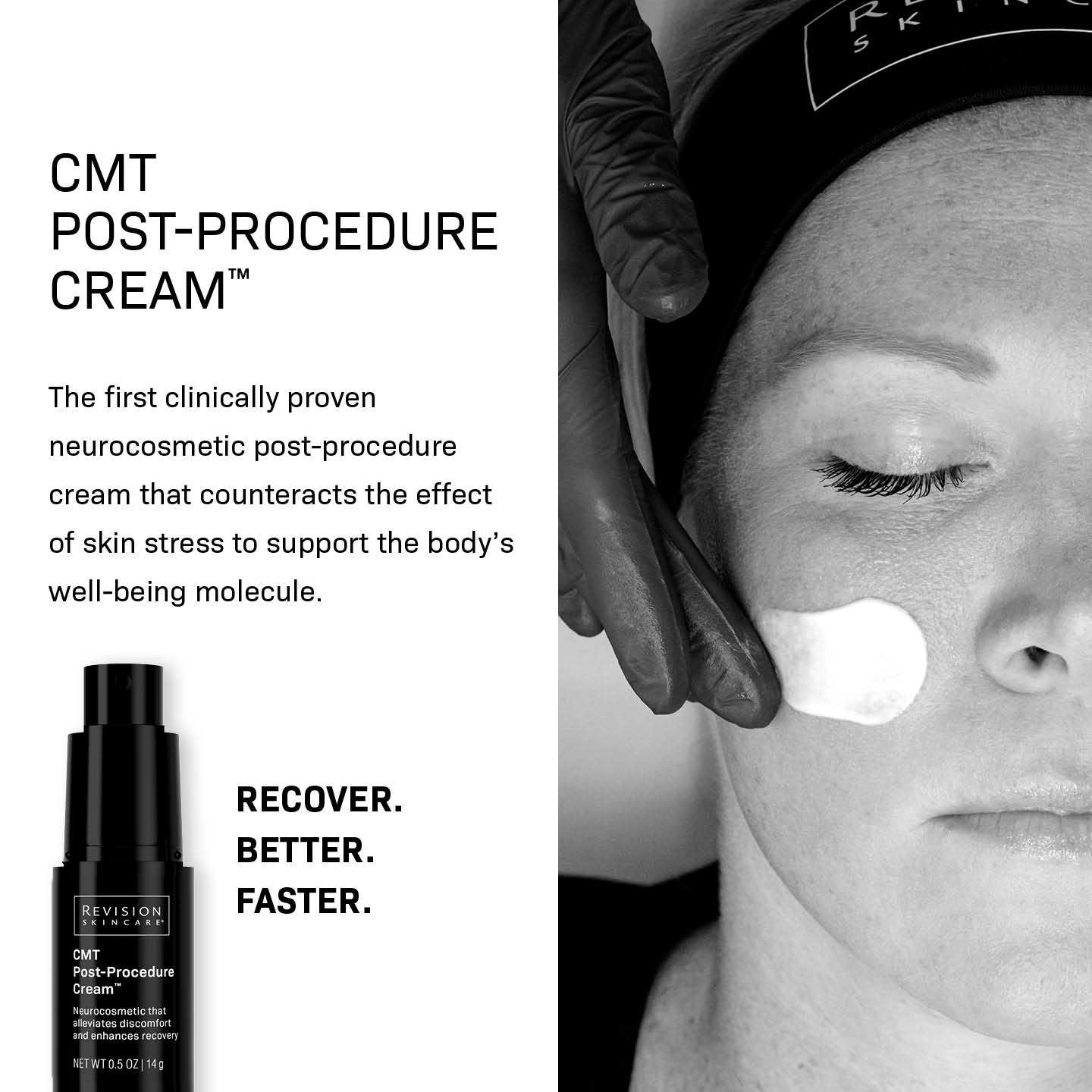 CMT Post-Procedure Cream