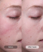 Radiance+ Resurfacing Serum 1 oz